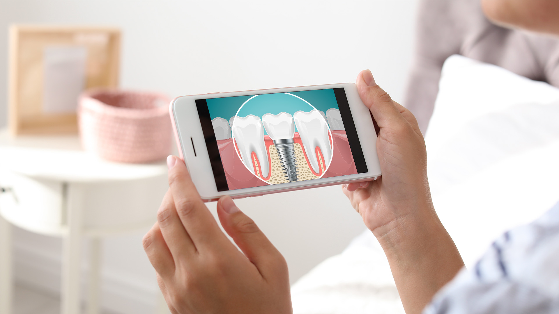 Person holding a smartphone displaying an image of a dental implant with a focus on the implant s structure and design.