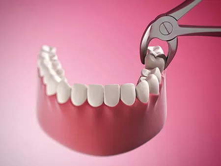 The image shows a close-up of a pair of scissors cutting into a dental implant or prosthetic tooth, with the focus on the act of trimming or adjusting the artificial teeth.