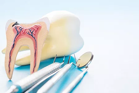 Anatomical model of teeth with a surgical instrument and dental tools, set against a blue background.