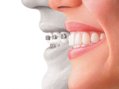 An advertisement featuring a smiling woman and a man s face with a focus on teeth, emphasizing dental care.