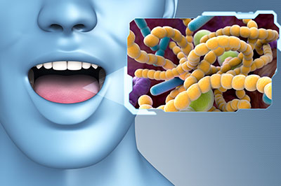 The image depicts a 3D rendering of a human face with an open mouth, overlaid on which is a microscopic image of bacteria or germs.