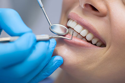 The image shows a person receiving dental care, specifically having their teeth cleaned or worked on by a dental professional, with the individual s mouth open and a dental tool visible.