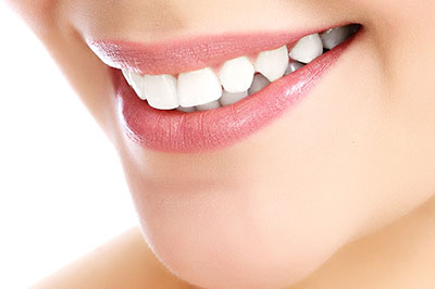 Smiling woman showcasing teeth whitening results.