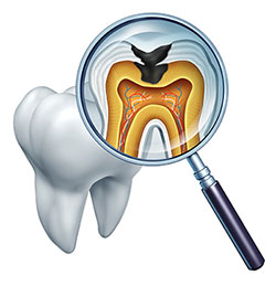 An illustration of a magnified tooth with an internal view, showing the root and surrounding tissue, viewed through a magnifying glass.