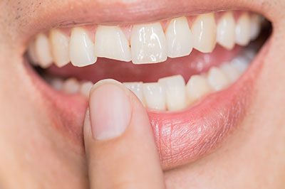 The image shows a person s hand holding a toothbrush with toothpaste, positioned in front of a smiling mouth.