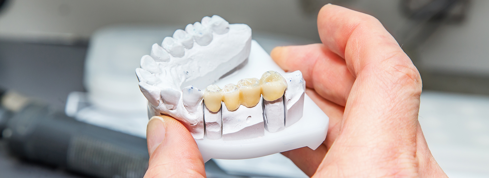 The image shows a person holding a white dental model with teeth, likely for educational or demonstration purposes.