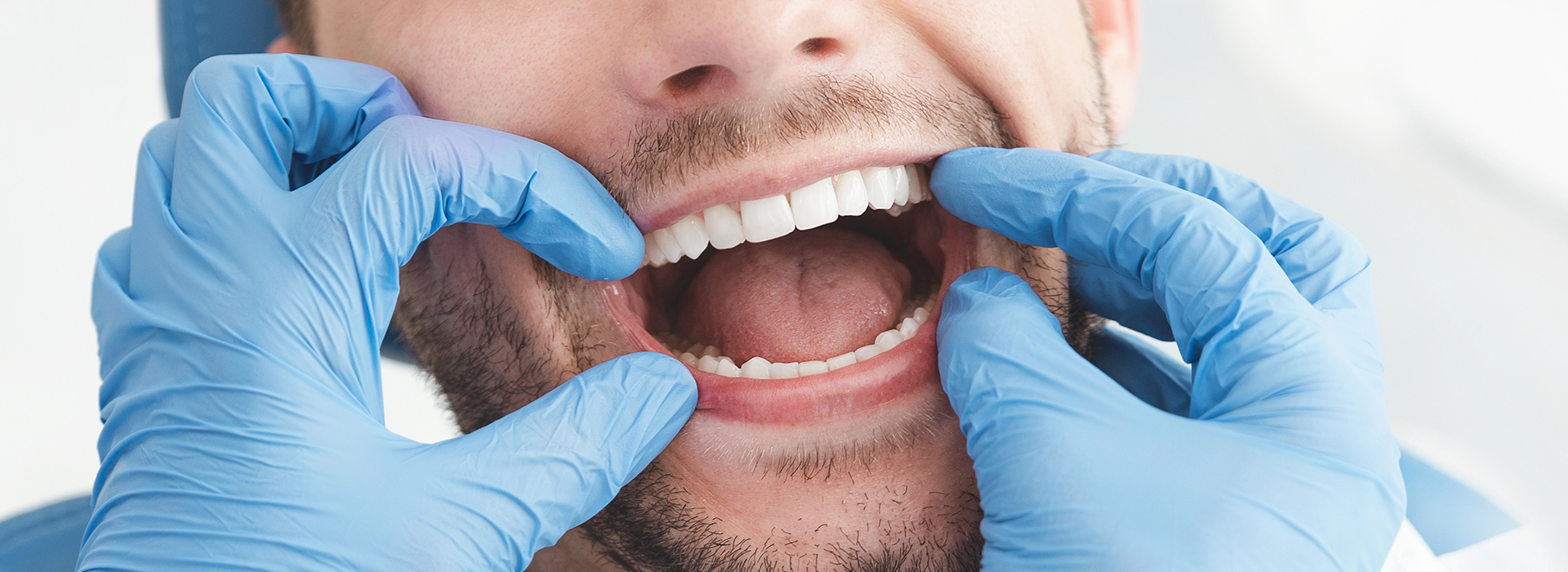 The image shows a man in a dental or medical setting, wearing blue gloves and holding his mouth open with a device that appears to be used for dental procedures.