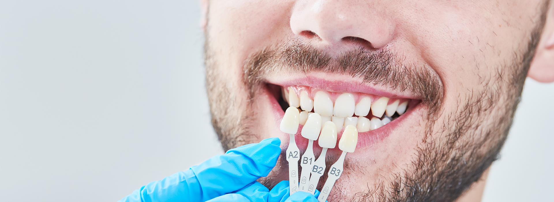 The image shows a person with a smile, wearing dental braces and a blue surgical mask.