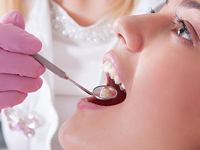 The image shows a dental professional using a dental drill to work on a patient s teeth.